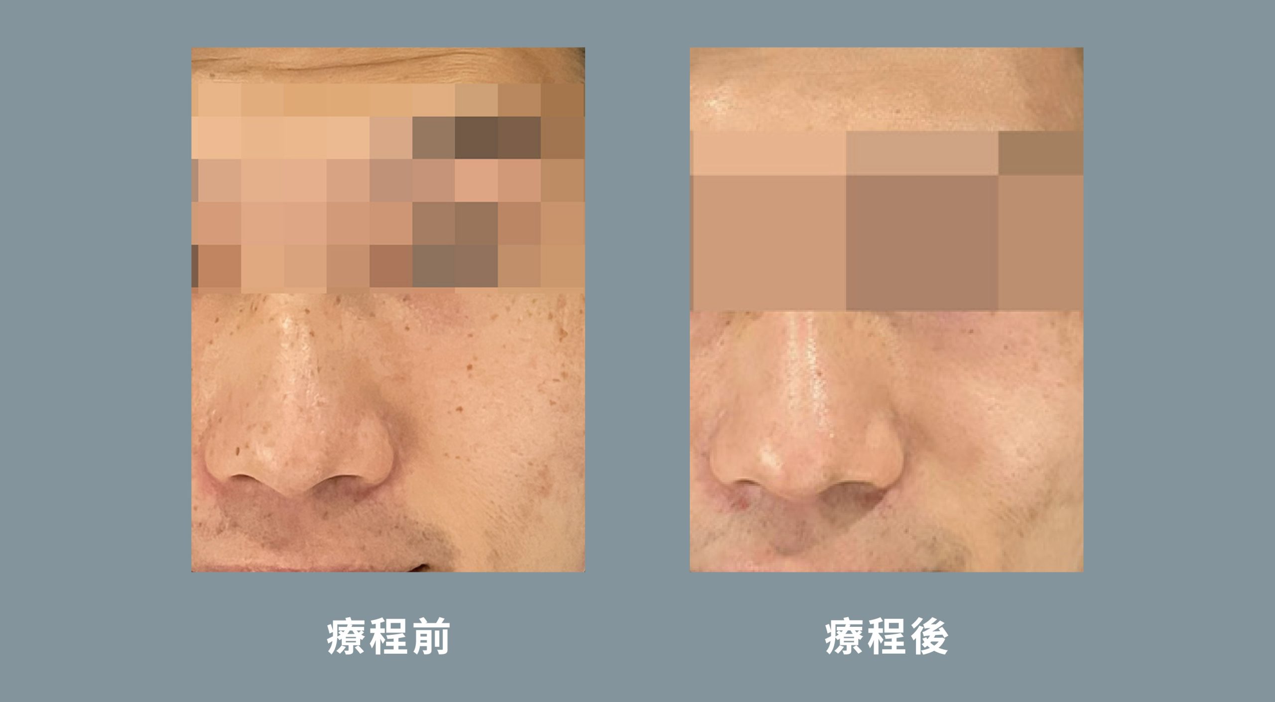 Pico Befroe and after desktop-03