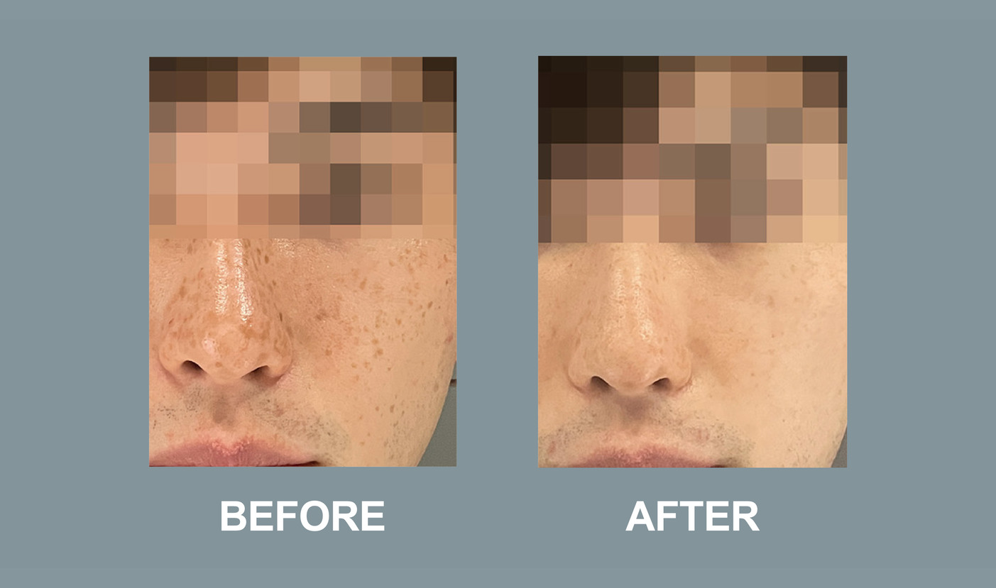 Pico Befroe and after desktop-02