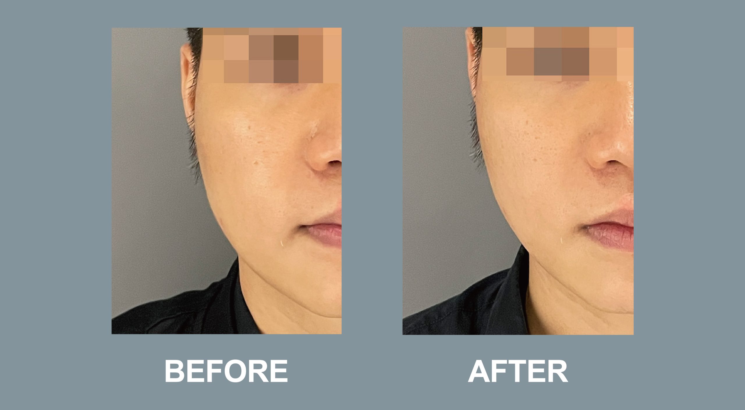 Tightening Befroe and after desktop-01