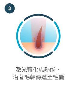 激光脫毛怎樣運作 - LaserKool｜100…